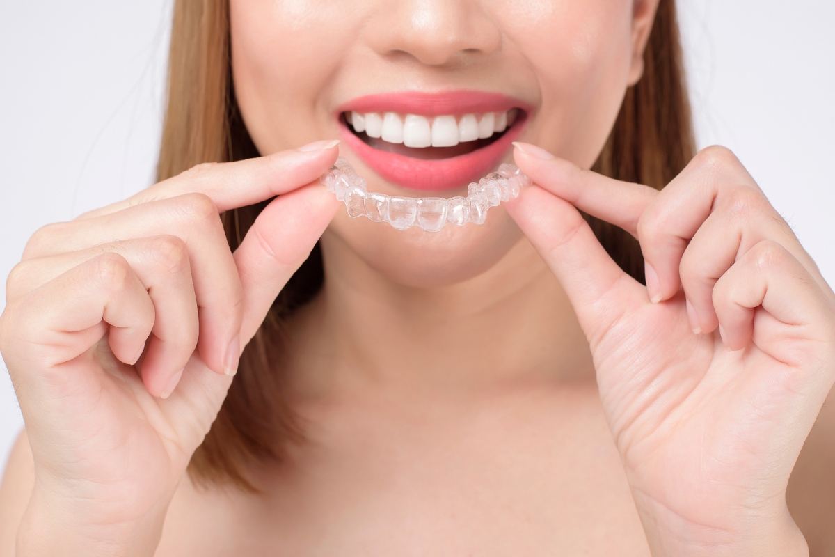 Invisalign in Irvine