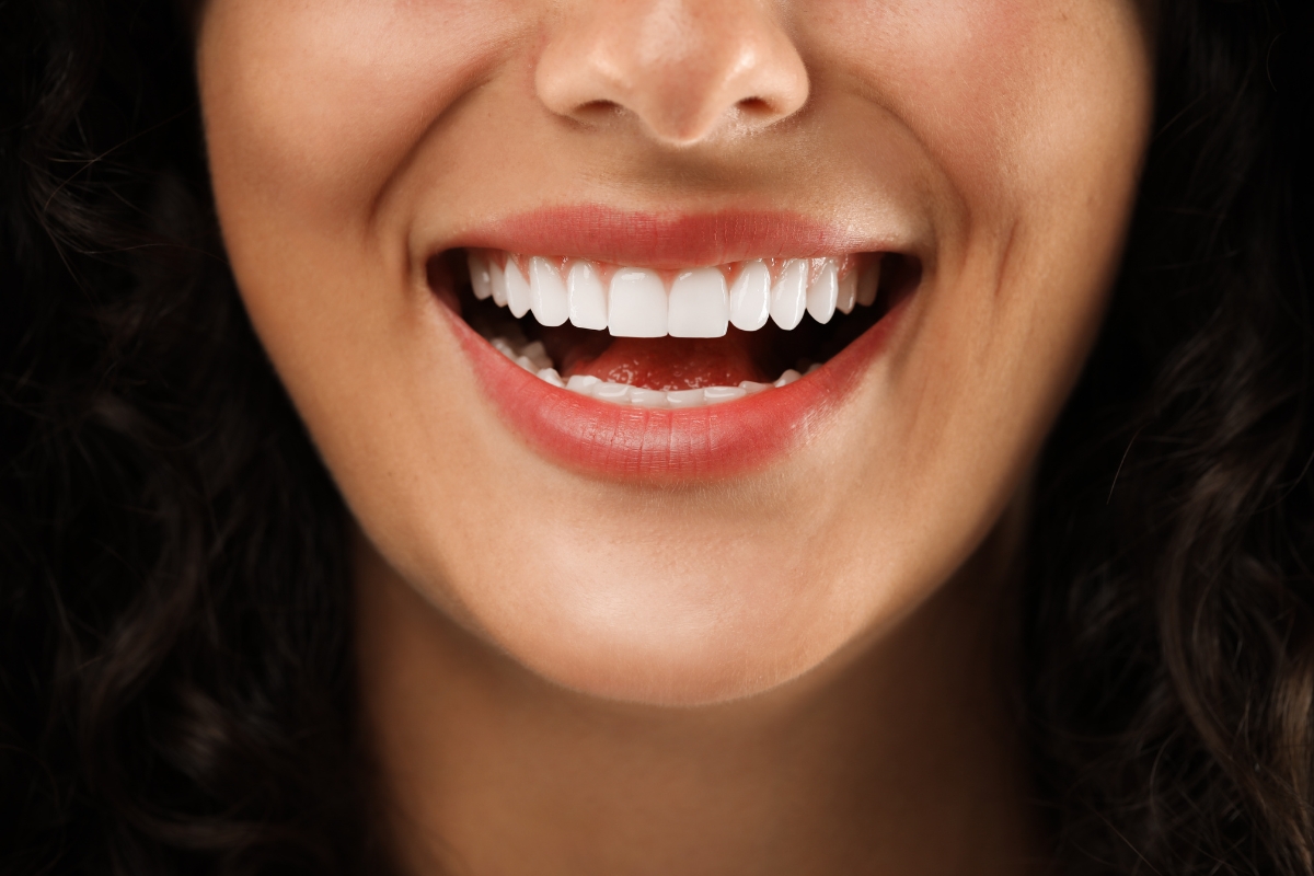 cosmetic dentist in Irvine
