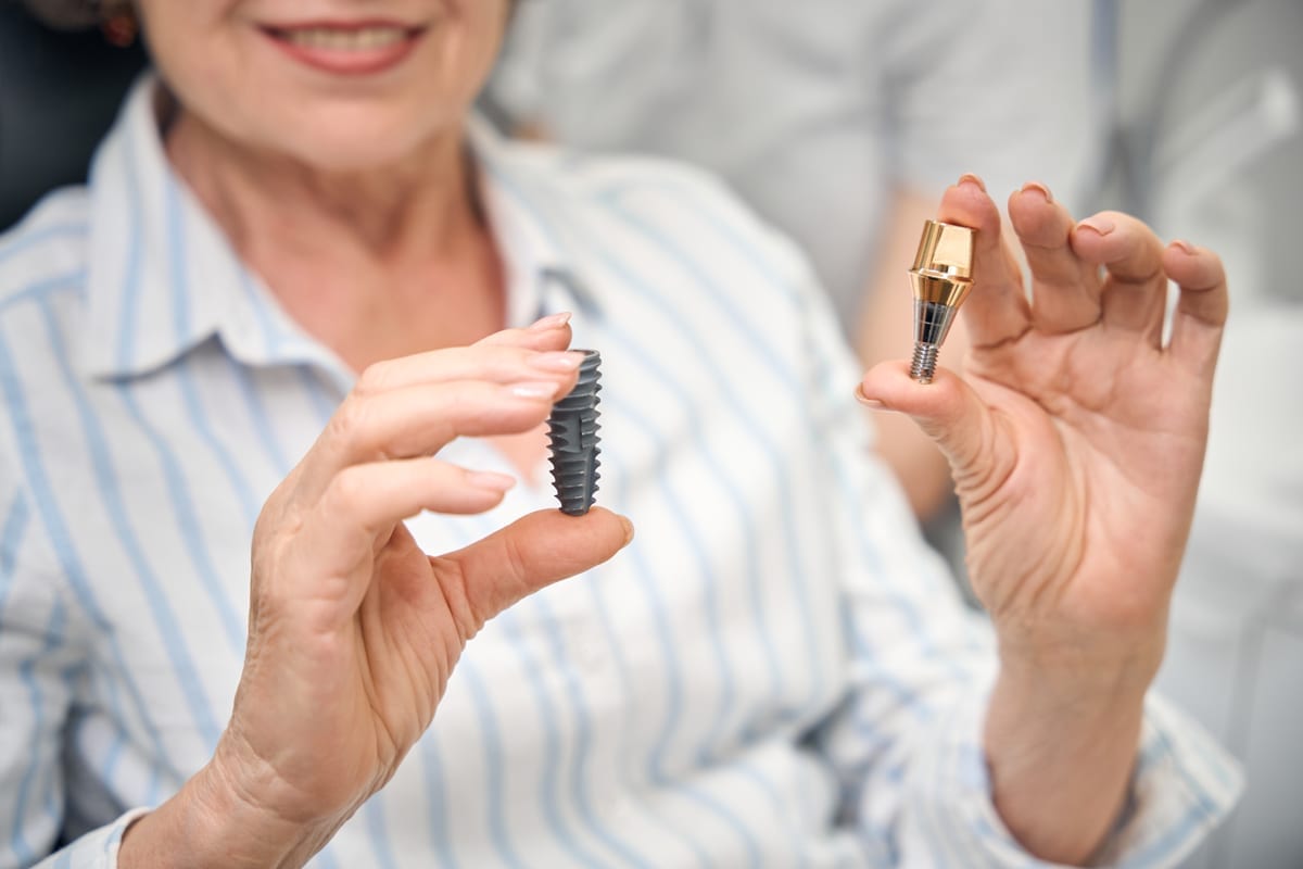 Dental Bridges in Irvine